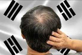 جنگ رئیس‌جمهور کره‌جنوبی با کچلی | دولت مامور پیشگری شد!