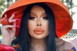 خواننده مشهور در شعله‌های آتش گرفتار شد