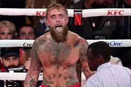 فک شکسته حاصل مبارزه اینفلوئنسر جنجالی با بوکسور حرفه‌ای