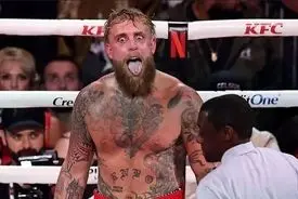 فک شکسته حاصل مبارزه اینفلوئنسر جنجالی با بوکسور حرفه‌ای